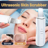 Ultrasonic Skin Scrubber — Blackhead Remover & Deep Pore Cleaner Face Tool