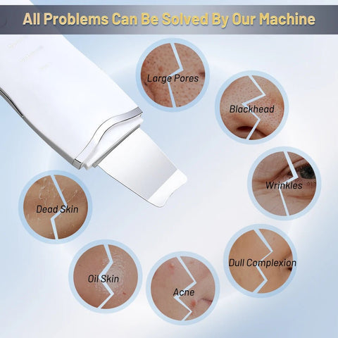 Ultrasonic Skin Scrubber — Blackhead Remover & Deep Pore Cleaner Face Tool
